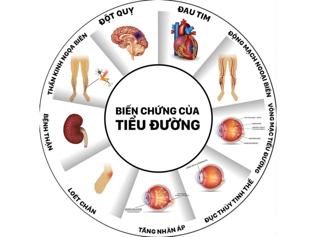 Bệnh tiểu đường nguy hiểm ở chỗ nào1