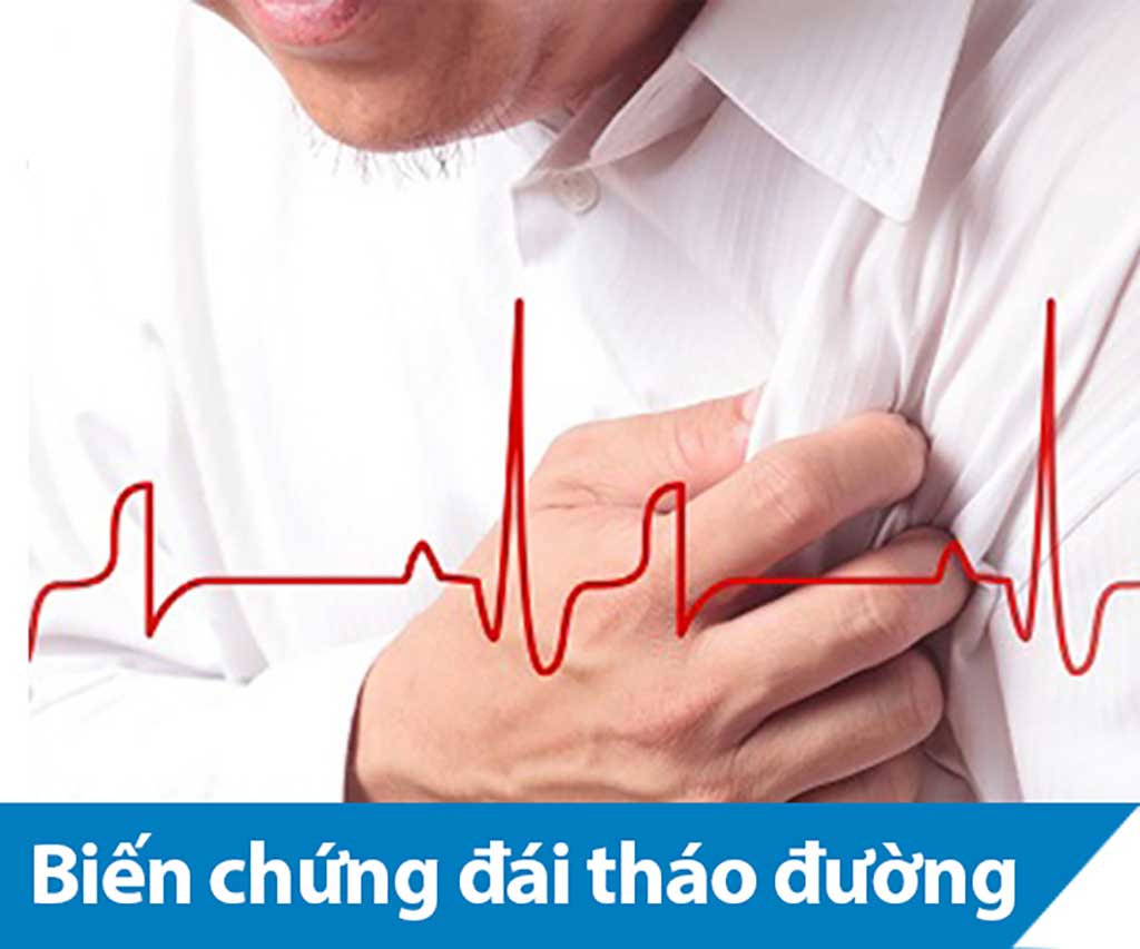 Bệnh tiểu đường nguy hiểm ở chỗ nào2