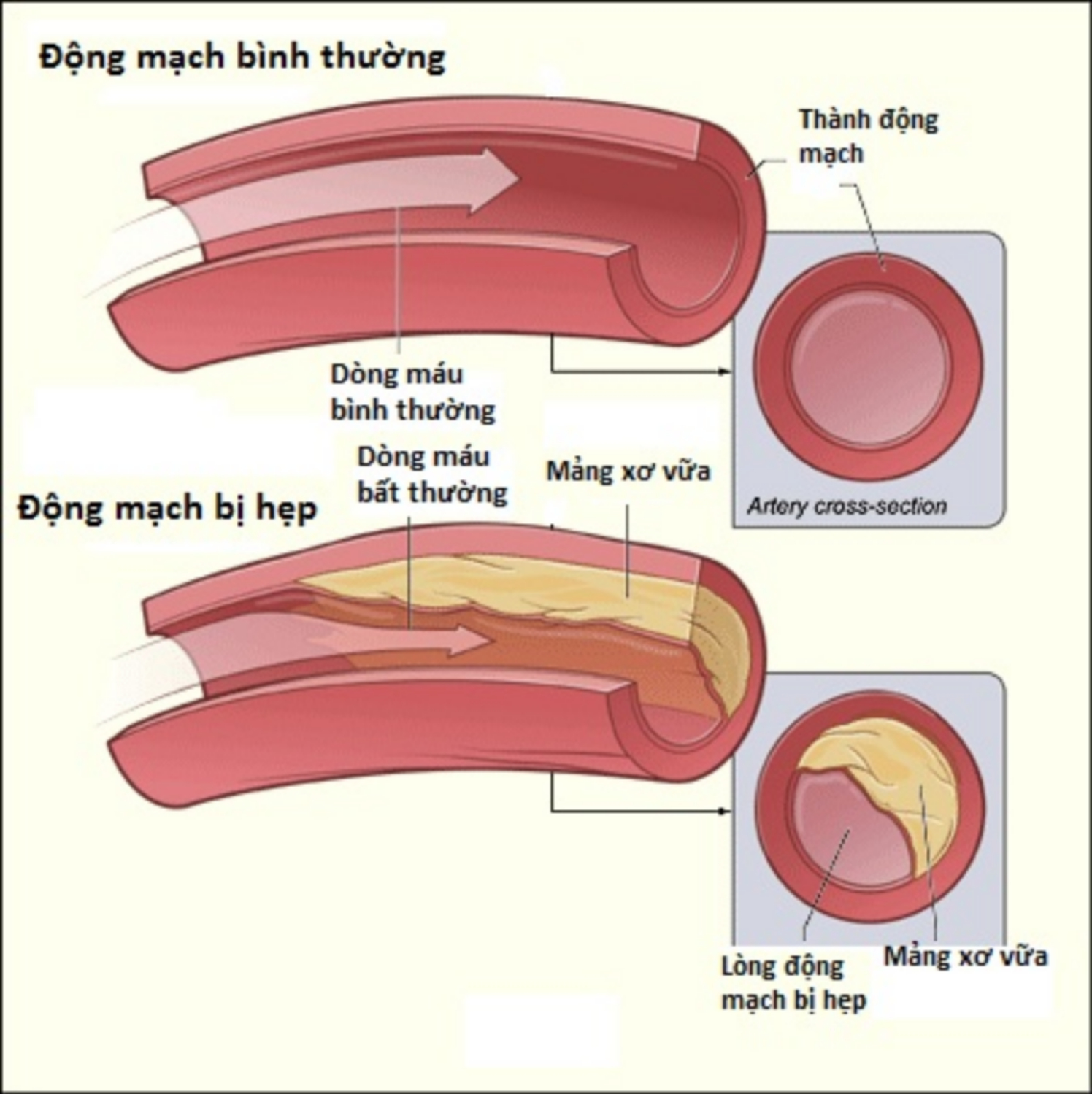 Phân loại bệnh tiểu đường như thế nào3