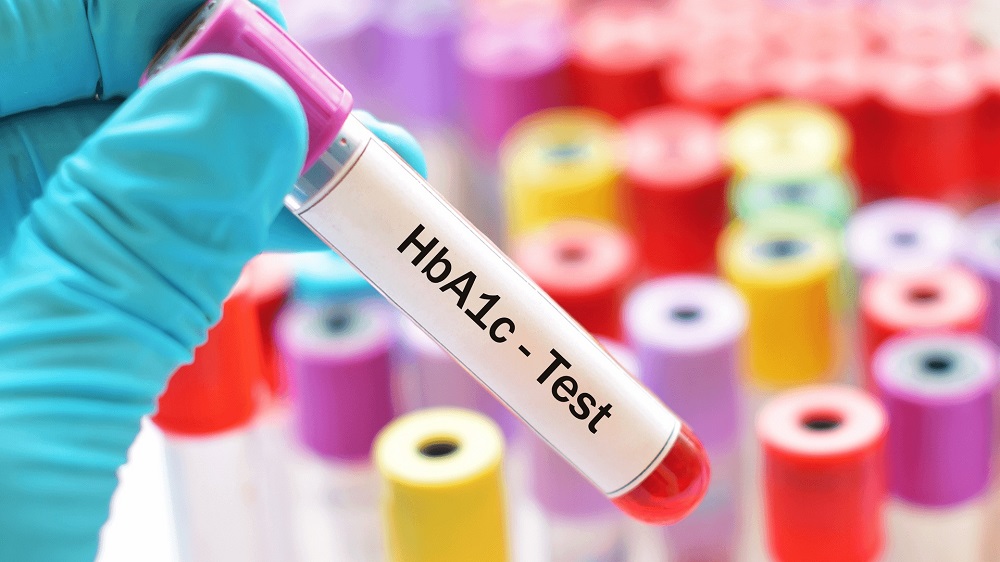 HbA1c la gi