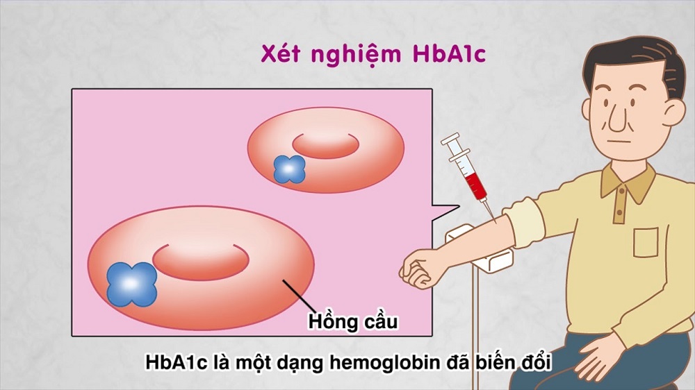 HbA1c la gi 2