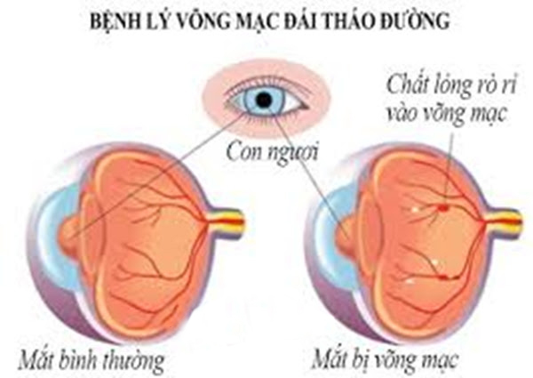 Người cao huyết áp không nên ăn những món này